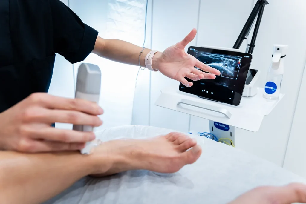Ecografía musculoesquelética en fisioterapia para diagnóstico preciso en Chamartín, Madrid